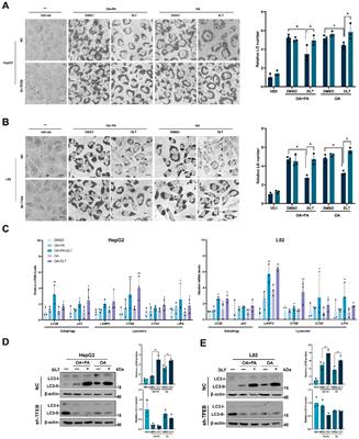 The novel TFEB agonist desloratadine ameliorates hepatic steatosis by activating the autophagy-lysosome pathway